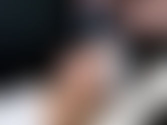 Amazing NEW Microcurrent Treatment