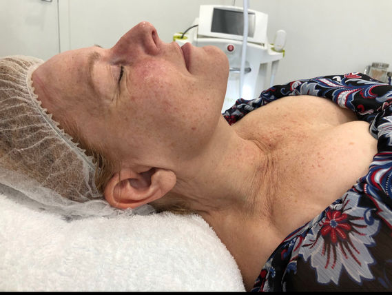 Face & Neck -B2.jpg