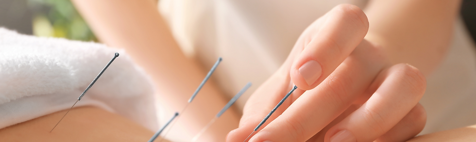 website acupuncture icon.png