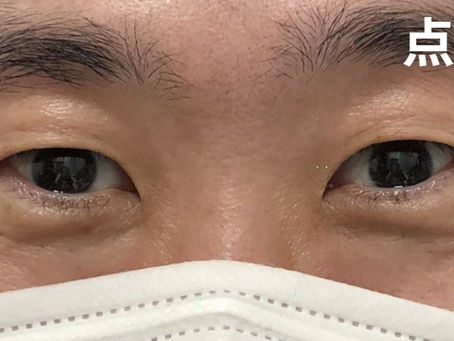 アップニークミニ、効く人・効かない人