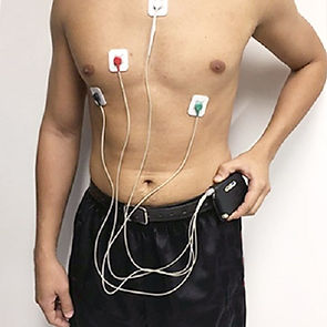 Holter_24h.jpg