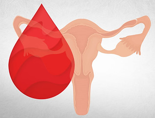 Sangramento-uterino-anormal.jpg
