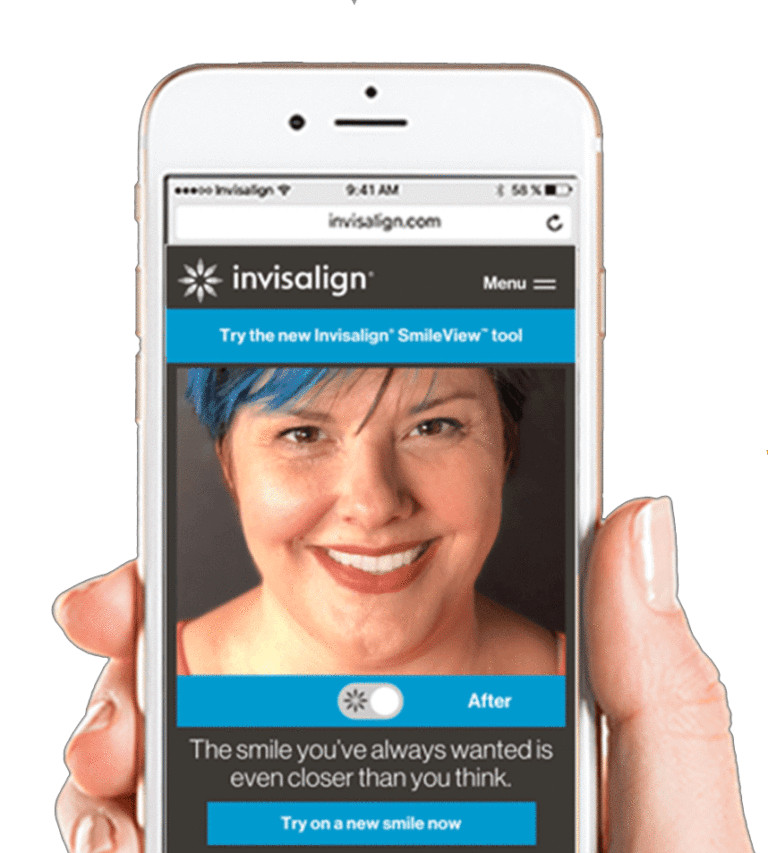 invisalign-lentes-de-contato-dental-protese-dentaria-sao-paulo-indaiatuba-viviany-openheimer