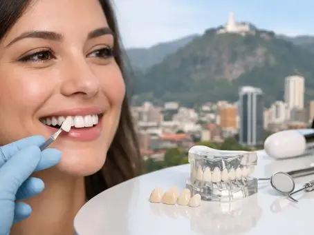 Carillas dentales Bogotá: Qué debes saber