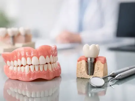 Guía para prótesis dentales con criterio