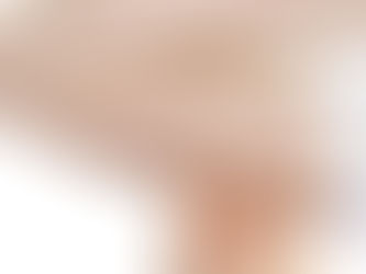 Implanon agora pode durar até 5 anos? Entenda o que mudou!