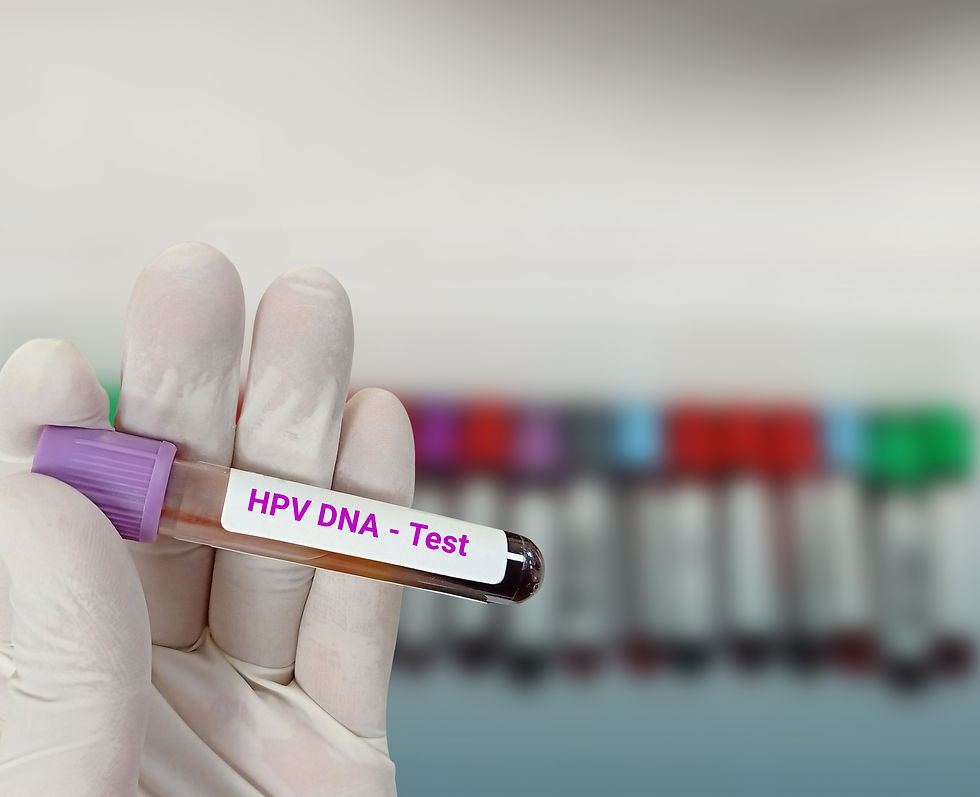 Teste de DNA para HPV: um avanço importante no rastreamento do câncer de colo do útero