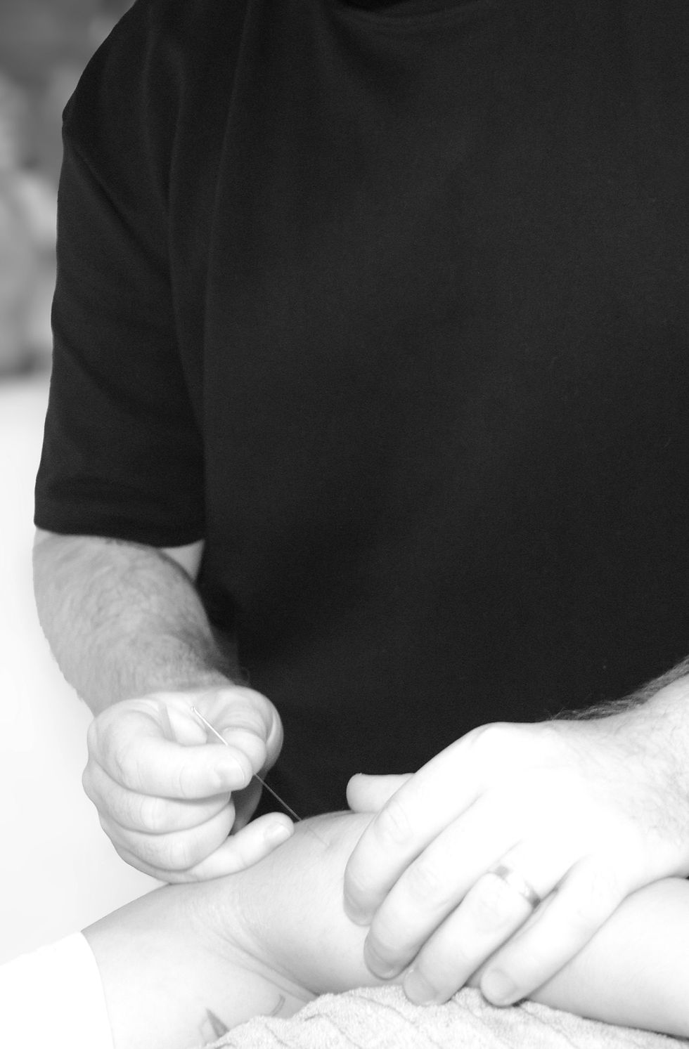 Dry needling procedure performed by Dr Kristian Vidakovic for injury management, at MyOsteopathy, Clyde North.