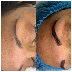 Microblading Before and After