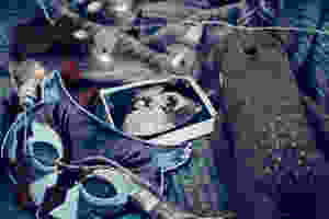 baby scan photo and teddy