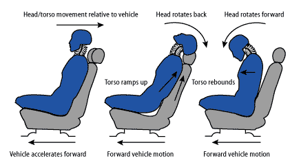 How Gonstead Chiropractor treats Whiplash