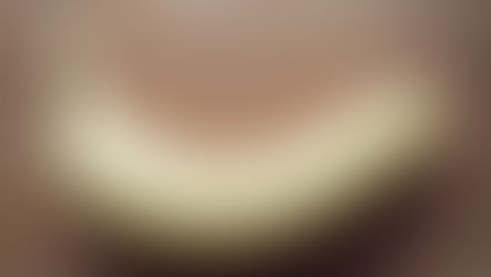 تعرفوا على أحد أكثر الأمراض تسبباً للقلق عند الرجال.. مرض بيروني