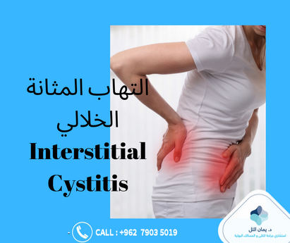 التهاب المثانة الخلالي وافضل علاجاته من أكثر أمراض المسالك ازعاجا للسيدات