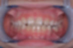 Thumbnail: AMCOP  Integral Plus 55-65mm Deep Red