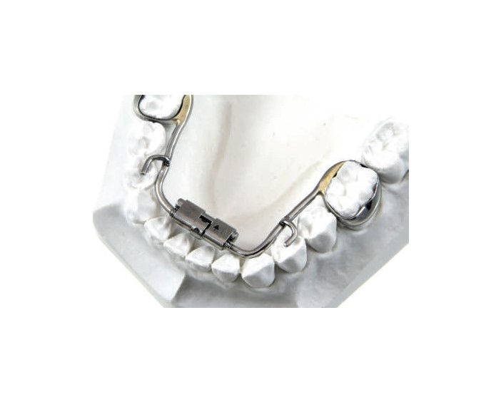 Thumbnail: RPE Leone MICRO EXPANDER Leone 8-11 mm