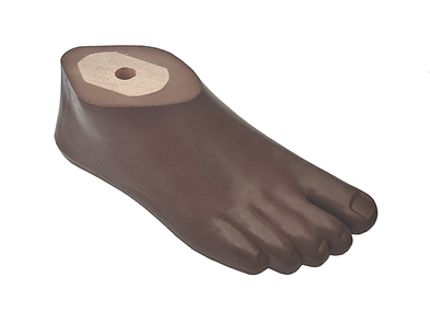 Paediatric SACH foot.png