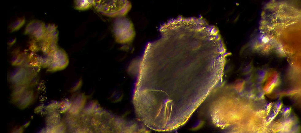 Ameba testada vista desde un microscopio