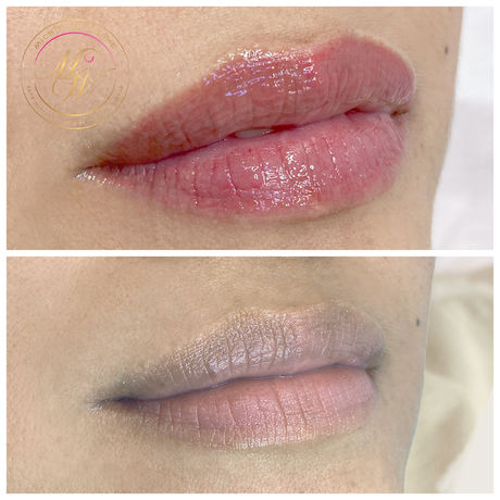 Lip Blush permanent makeup, lip tattoo, permanent lipstick tattoo result in Richmond, lip semi permanent colour, tattoo lipstick, permanent lipstick near Chiswick, specialist lip tattoo for old skin, mature skin lip tattoo, natural looking lip tattoo for older women, permanent lip liner, lip outline tattoo, healed results after one session lip tattoo, permanent lip definition colour, lip microblading, lip natural tattoo, naturally looking lip tattoo near Kew and Richmond, Richmond permanent makeup specialist, before and after lip tattoo blush, healed results after one session of lip tattoo, final results after lip permanent makeup