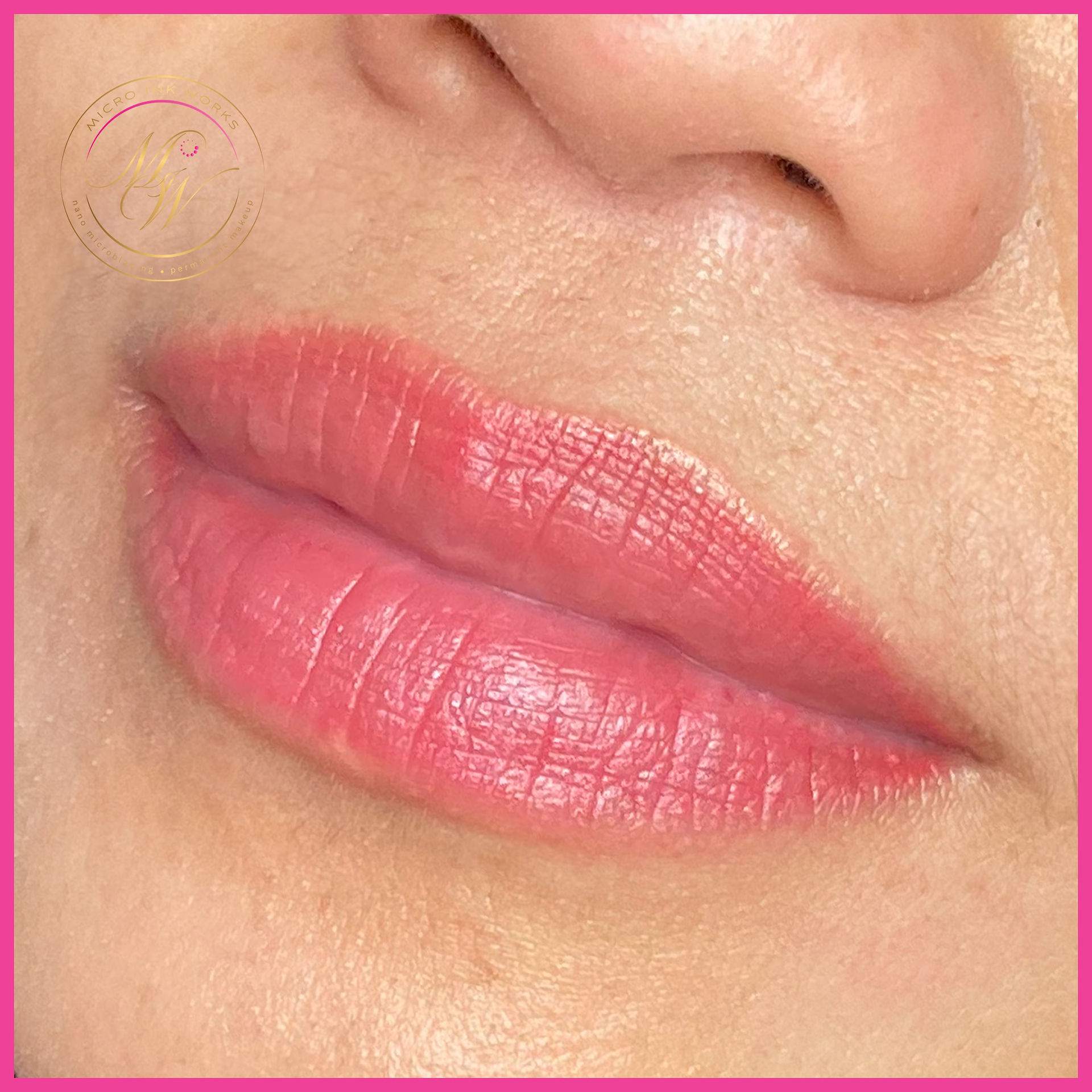 Lip Neutralising and Permanent Lipstick -2 sessions - results after 20 months