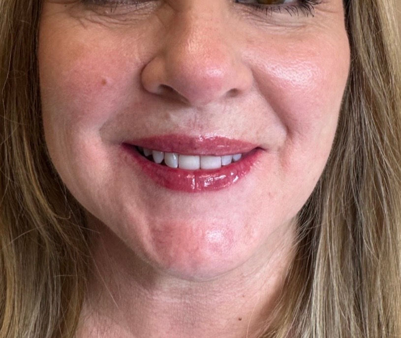 Fully healed lip blush after 10 weeks by Kasia Herdman, Blush Permanent Make Up | Woodstock, GA