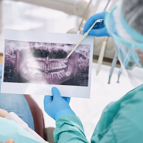 teeth-removal.jpg