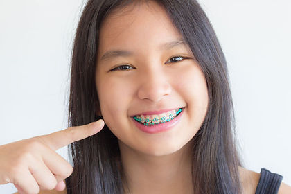 braces.jpg