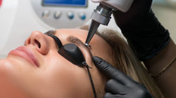 remoção pigmentação Porto Alegre