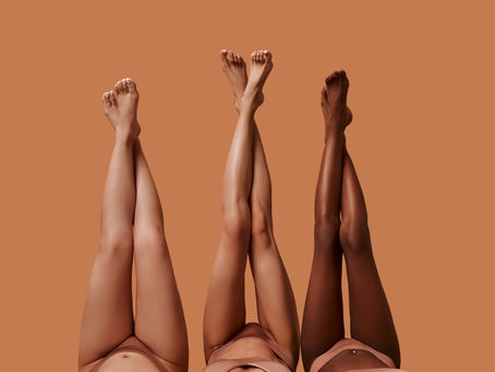 Laser Hair Removal for PCOS: A Long-Term Solution That Works