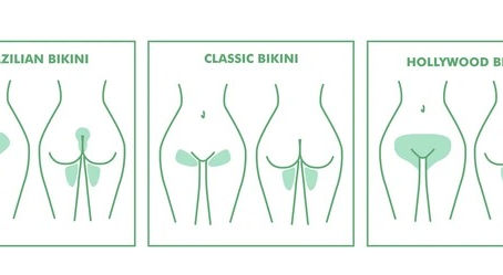 Laser Hair Removal for the Bikini Area & Popular Styles Explained
