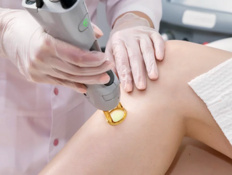 Laser Hair Removal vs. Waxing: Which Is Better for Smooth, Hair-Free Skin?
