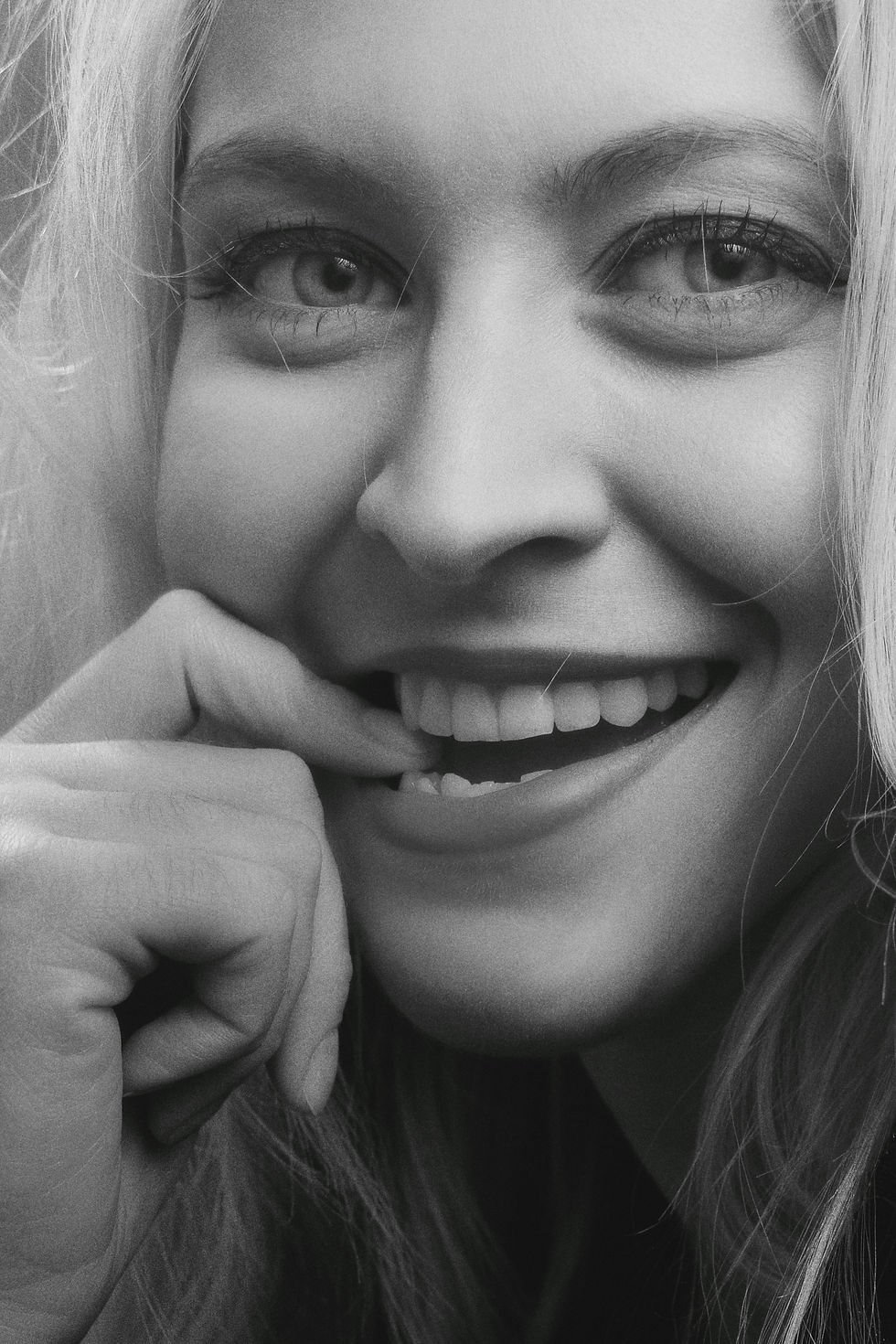 MARPE patient YP Ortho