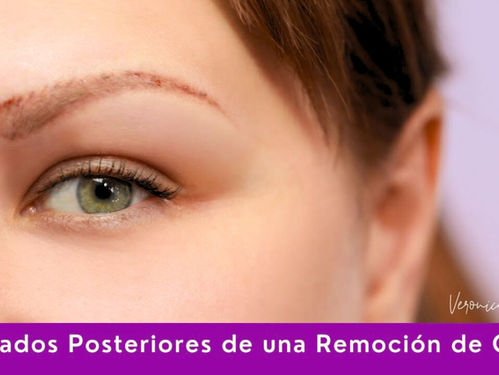 🧪 Cuidados posteriores de una remoción química de cejas: la fase crítica del éxito + VIDEO