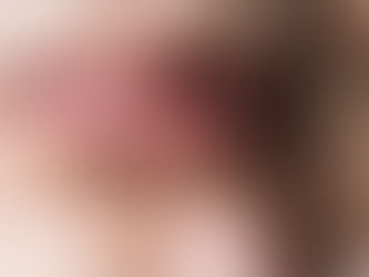 Que es Herpes Labial: Causas y Tratamientos. Lo que todo Micropigmentador debe Saber