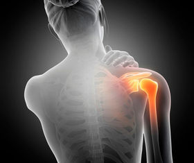 Capsulite rétractile : comprendre, soulager et retrouver plus de mobilité naturellement