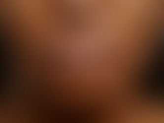 Comprendre l'hyperpigmentation sur les peaux foncées