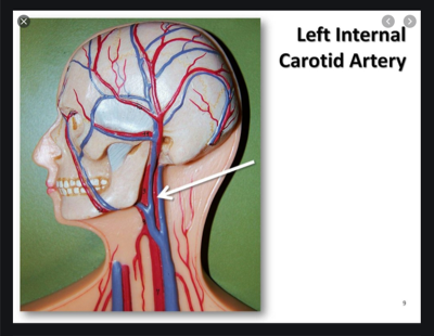 Vgreet Covid-19 Carotid Artery core temperature reading, Communication Edge