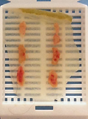 慢性腸症 内視鏡 生検