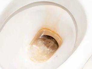 Comment détartrer la cuvette de ses toilettes