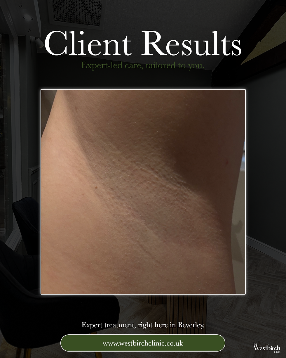 What one session of advanced laser hair removal can actually do…