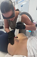 Summer appliying laser tatent to a womans back inside of he Westbirch Clinic