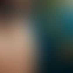 Il colore dell'occhio umano: una rassegna critica dei correlati morfologici, genetici e fisiopatologici della pigmentazione iridiale