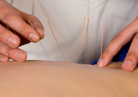 Acupuncture Therapy Session_edited_edited_edited_edited.jpg