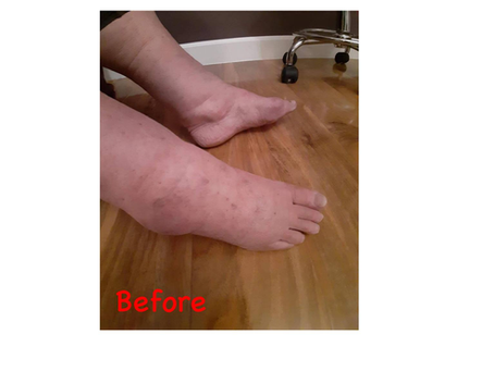 In Depth Guide to Reflexology Lymph Drainage Part 4