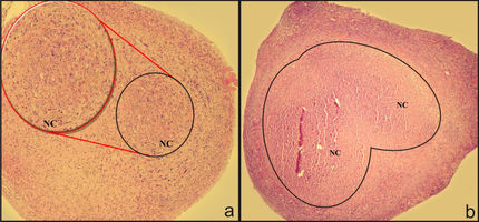 Histopathological evaluation of tumor necrosis and volume after cyanogenic chemotherapy