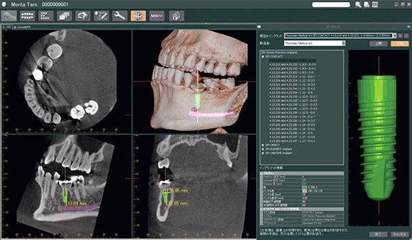 Veraviewepocs 3D R100