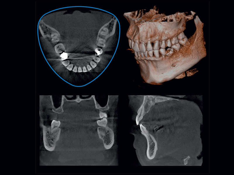 Veraviewepocs 3D R100