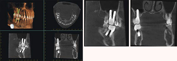 Veraviewepocs 3D R100