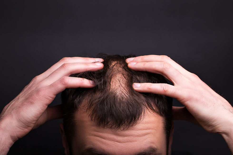 men-with-bald-head-black-wall-close-up.jpg