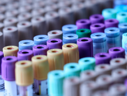 Gnosis Partnership to Deliver Breakthroughs in Advanced Diagnostic Testing