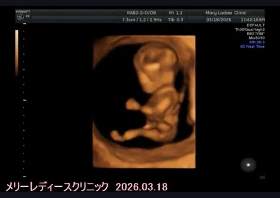 Look at this little person! Channeling great power in its little fists!
